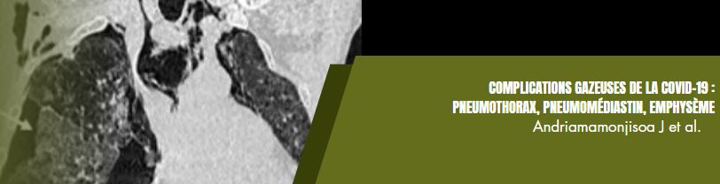 Complications COVID 19