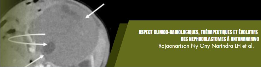 neprhoblastome